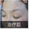 温州中研白癜风专科医院