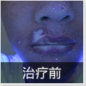 温州中研白癜风专科医院