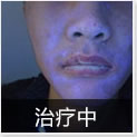 温州中研白癜风专科医院