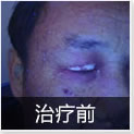 温州中研白癜风专科医院