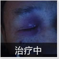 温州中研白癜风专科医院