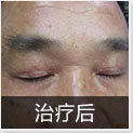 温州中研白癜风专科医院